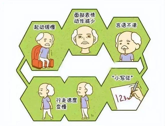 特发性震颤最新疗法,创新疗法应对特发性震颤