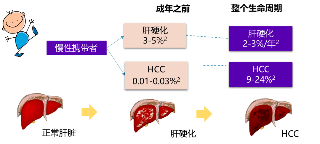 肝硬化的最新治疗方法,揭秘肝硬化革命性新疗法的突破进展